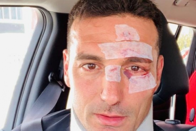 Lionel Scaloni 2