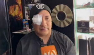 “Sentí el perdigón y sabía que perdí el ojo… ¡NO SOMOS DELINCUENTES, atrás mío había 2 Niños!”